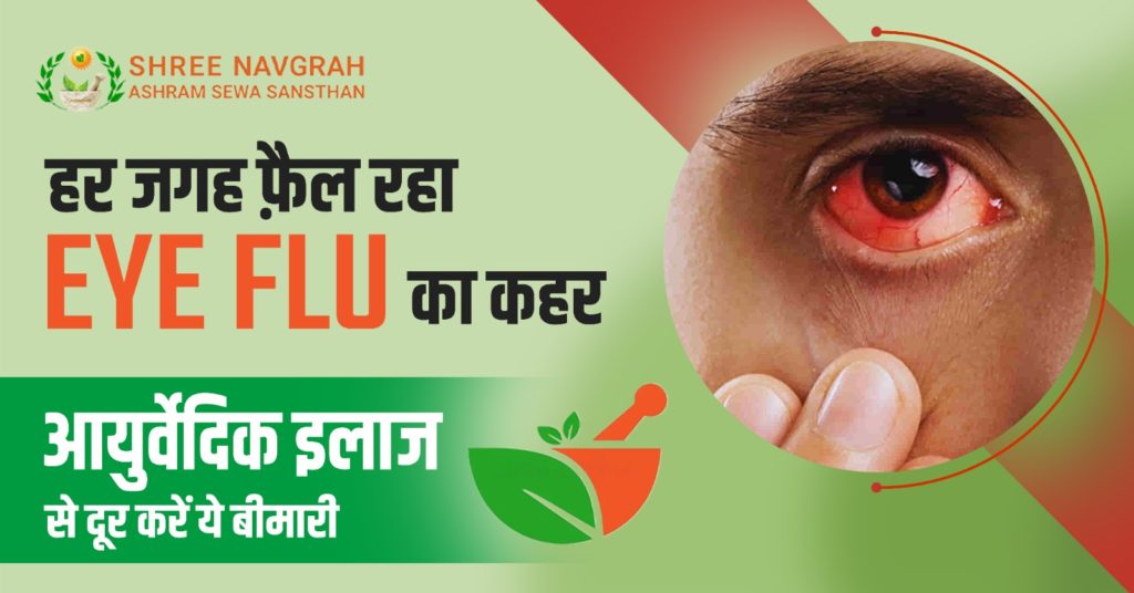 हर जगह फ़ैल रहा Eye Flu का कहर, आयुर्वेदिक इलाज से दूर करें ये बीमारी