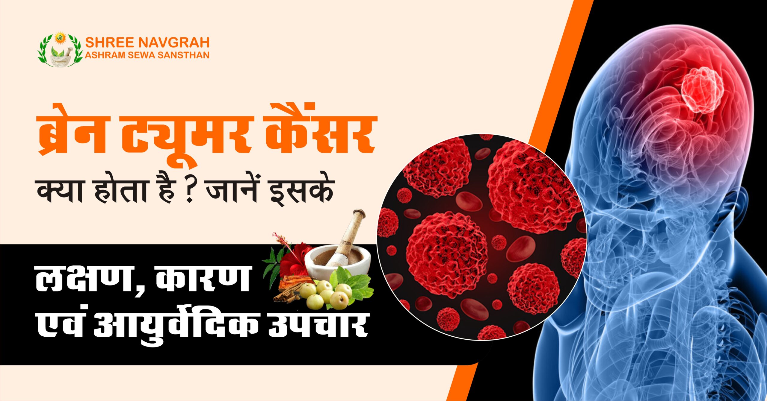 brain-tumor-symptoms-causes-ayurveda-hindi